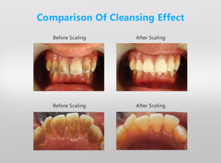 Zdjęcia 14.07.2020 15_55_02.png