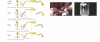 Implantation 2.png
