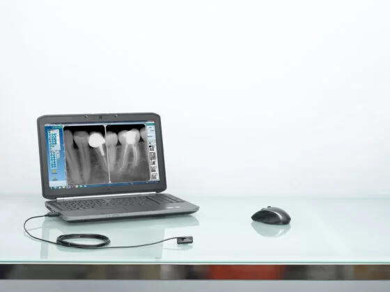 Capteur_Portable_souris_table_2-560x420.webp